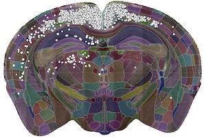 Brain Globe Image