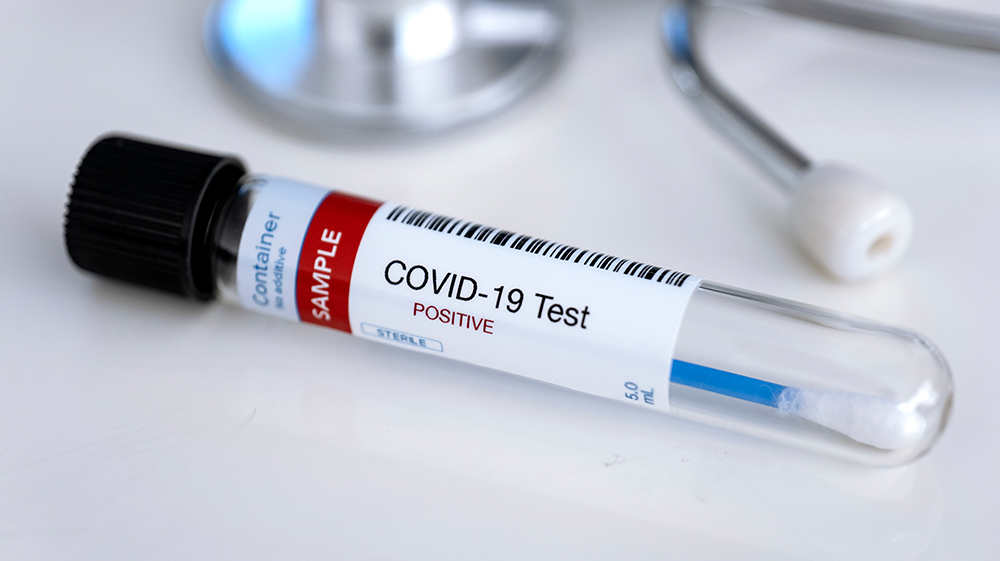 A vial of blood labeled as a COVID-19 positive sample.