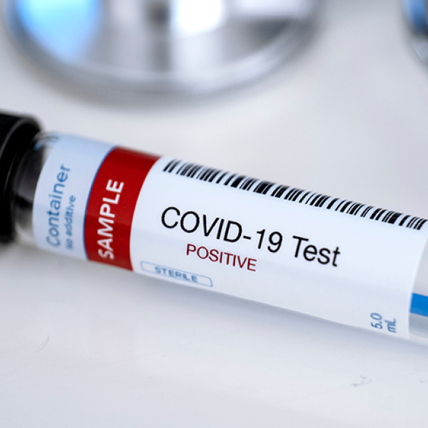 Positive COVID test