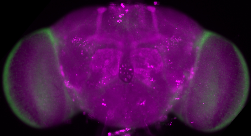 Whole-mount immunofluorescence of a Drosophila brain expressing expanded Huntingtin (Htt-128Q) in the brain 