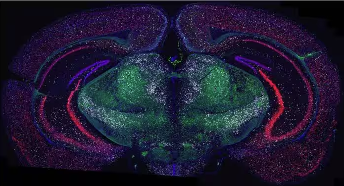 Spatial Biology Symposium: Visualization of Diverse RNA Biomarkers to ...