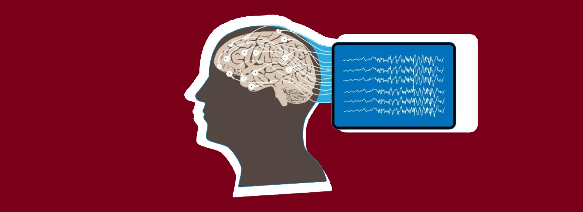 Cutting edge eeg algorithm patient care