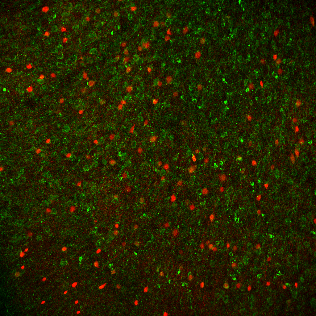 a confocal image of the mouse cortex, in which green cells are excitatory neurons (labeled with anti-CaMKII antibody) and red cells are inhibitory neurons (expressing Parvalbumin). The photo was taken by Dr. Owen Chao.