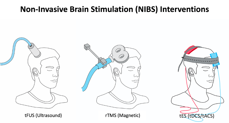 Non-Invasive Brain Stimulation Methods