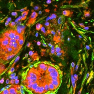 Immune-stimulated activity in pancreatic cancer cells (Dixit et al., JCI Insight 2022).