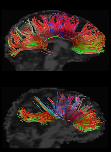 Colorful brain scans 