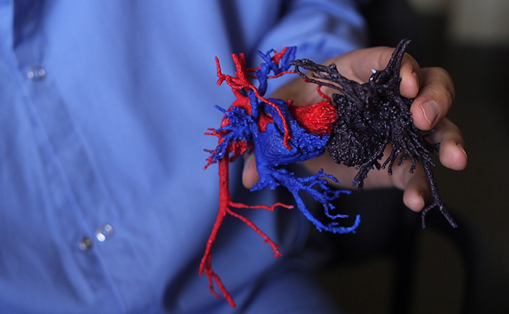 3d model of the twins' heart