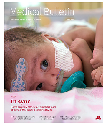 Medical Bulletin Cover for Fall 2017, Photo of conjoined twins