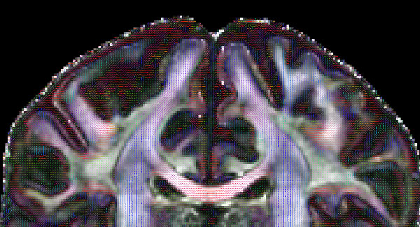 Image of a brain scan