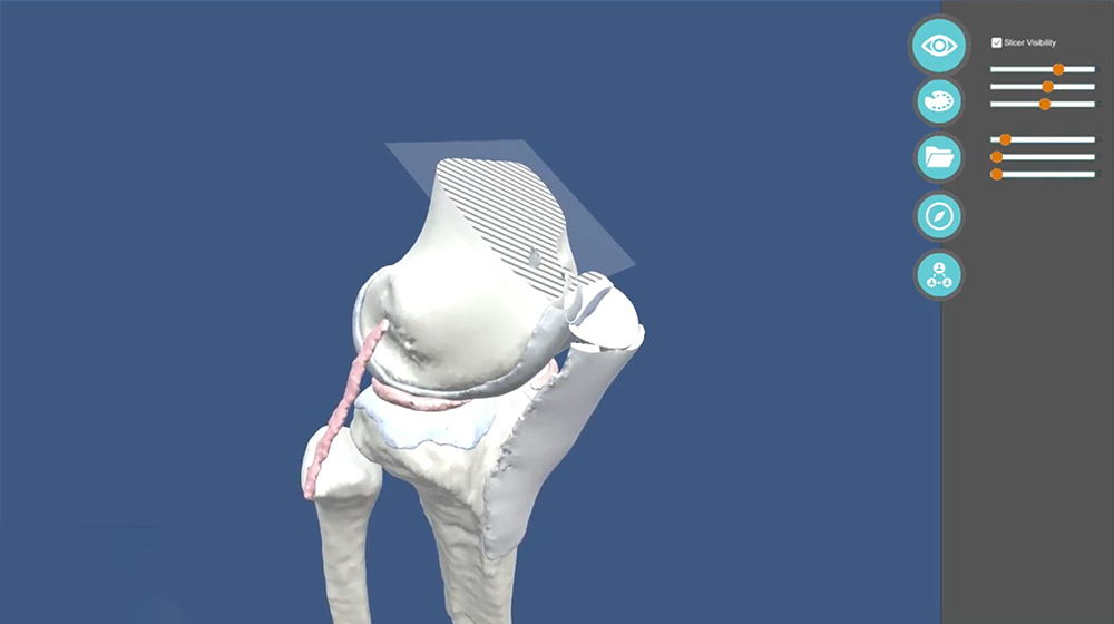 A virtual look at a bone.