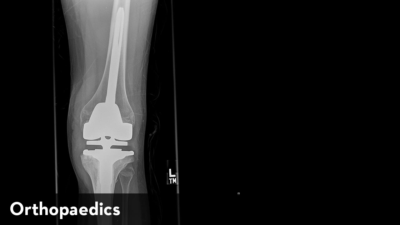 Xray image of a knee