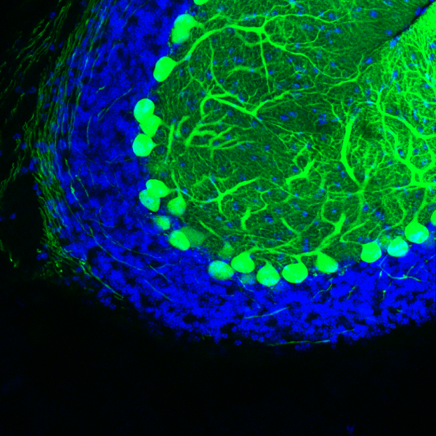 Purkinje cells in the mouse cerebellum 