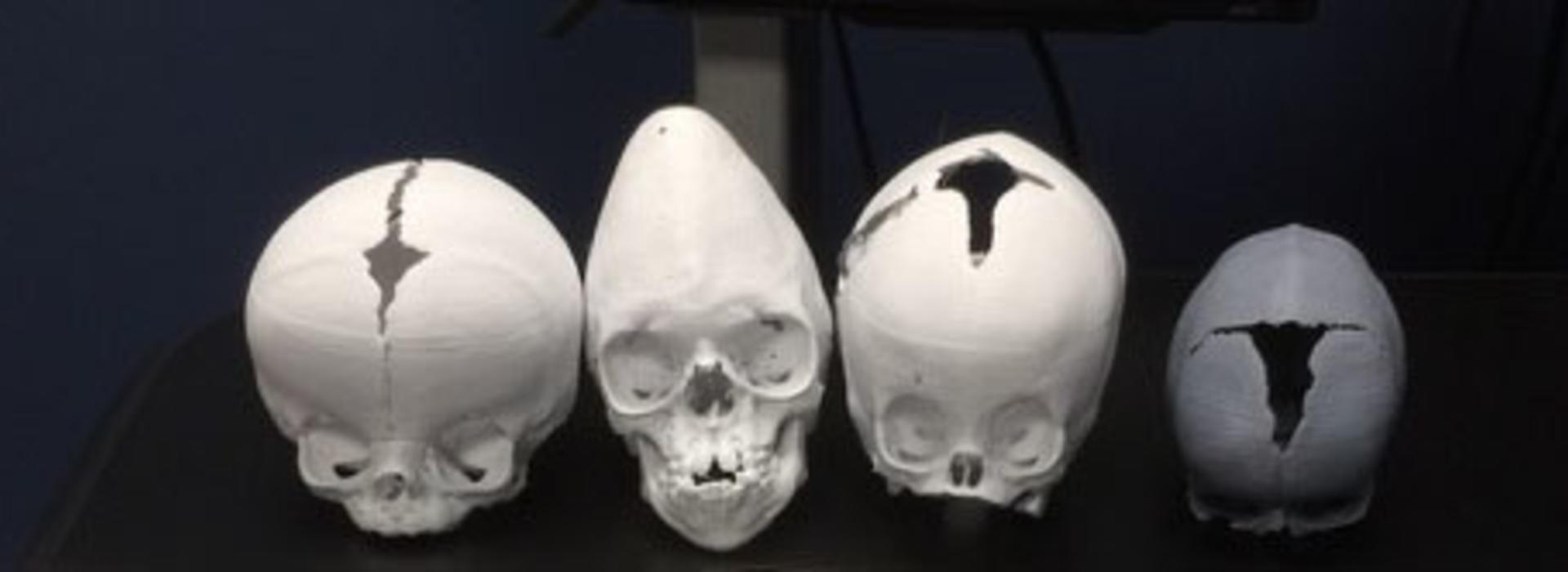 3D printed skulls