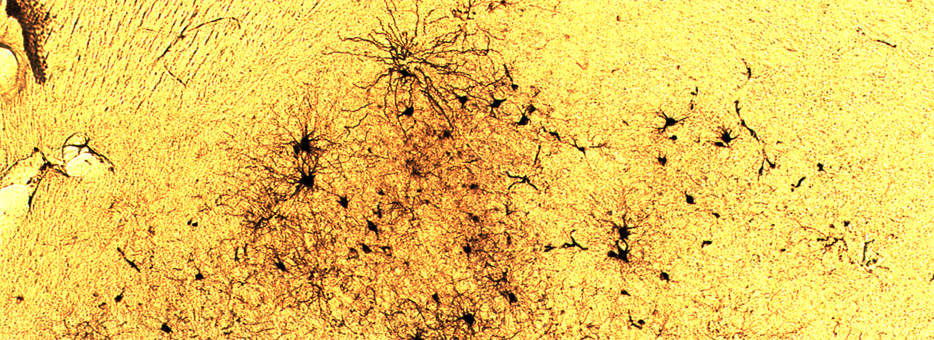 scientific image of brain connectivity