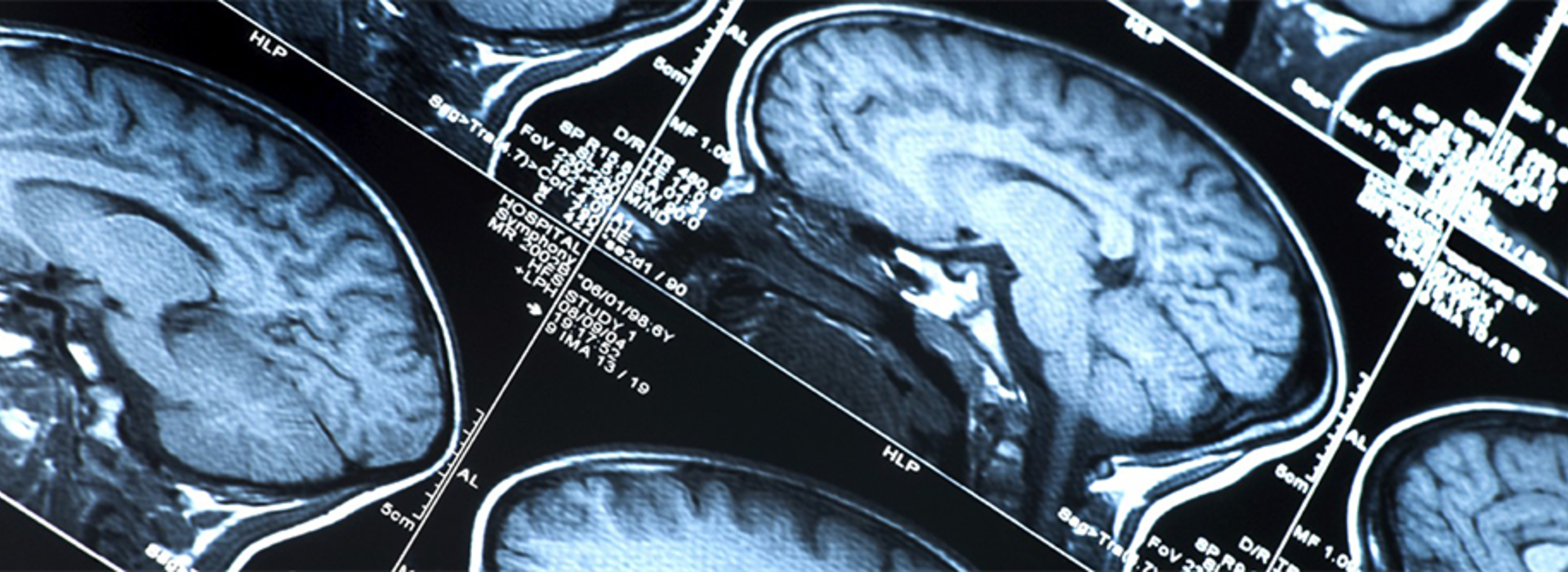 brain scans