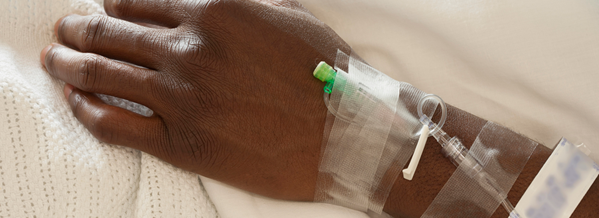 A Black man's hand with an IV