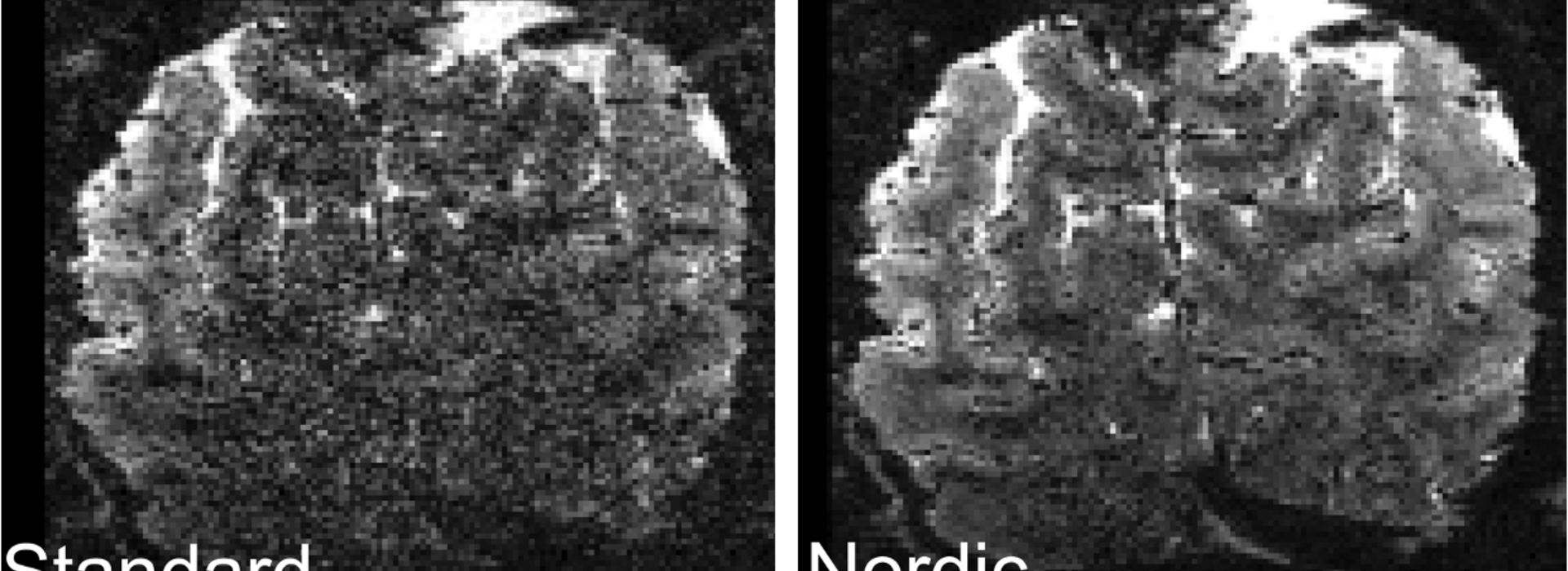 fMRI images of brain slices