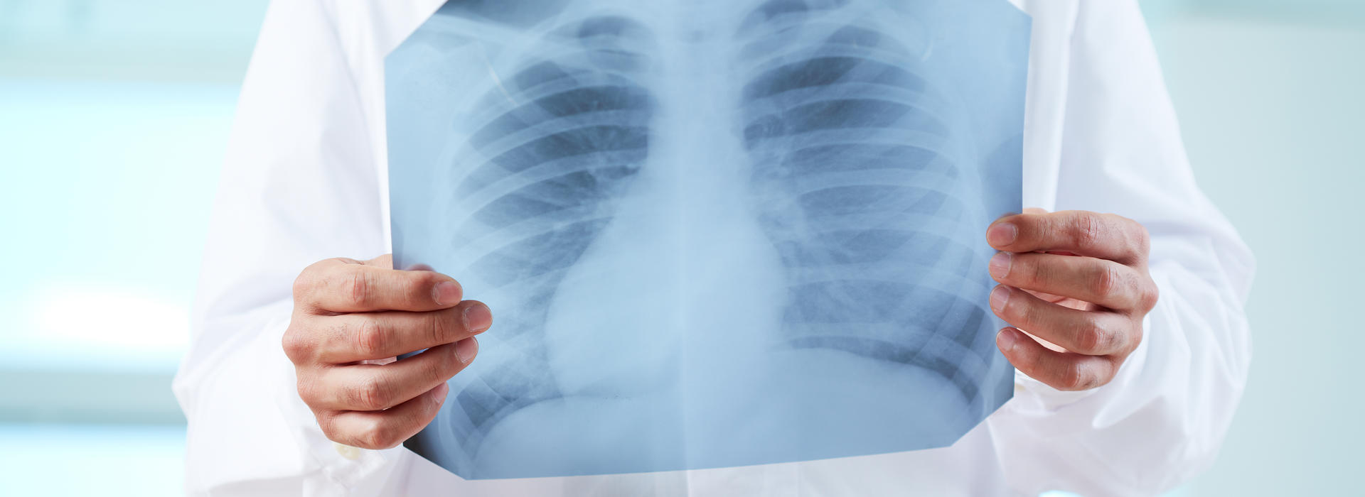 Doctor holding chest x-ray image over their ribcage