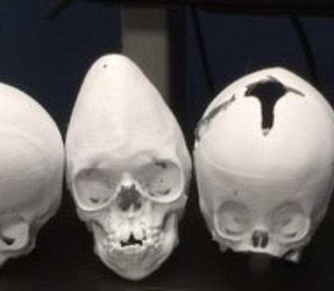 3D printed skulls