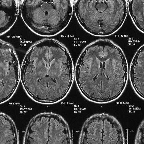 A picture of brain scans.