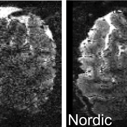 fMRI images of brain slices