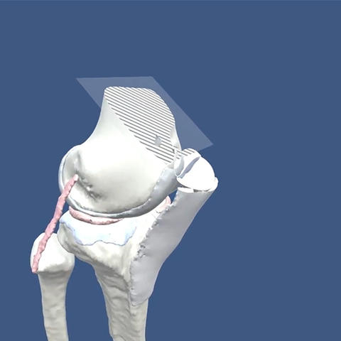 A virtual look at a bone.